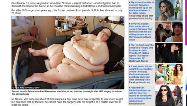 Ya no es el más gordo del mundo porque perdió 286 kilos