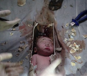 Bomberos rescatan a recién nacido atorado en una tubería (Fotos y Video)