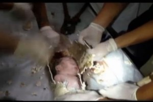 Rescatan a un recién nacido atrapado en una tubería de un baño público (Imágenes)