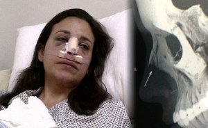 María Corina sale de quirófano y comienza recuperación (foto, diagnóstico y radiografías)