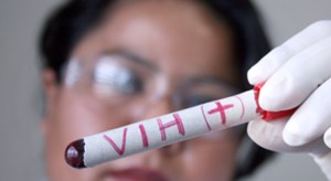 Medicina moderna puede mantener a raya al VIH pero no lograr su cura