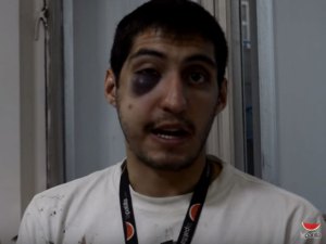 ¡Cobardes! colectivos atacaron por la espalda a periodista de La Patilla (VIDEO + testimonio)