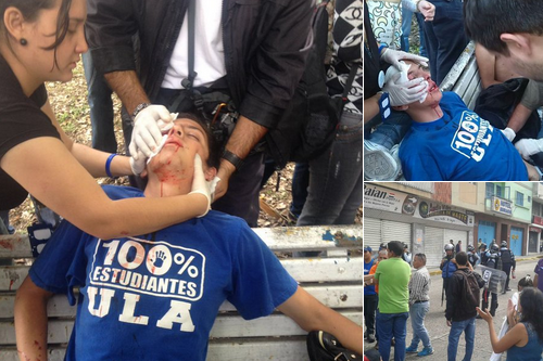 Heridos varios estudiantes durante manifestación pacífica en Mérida (Fotos)