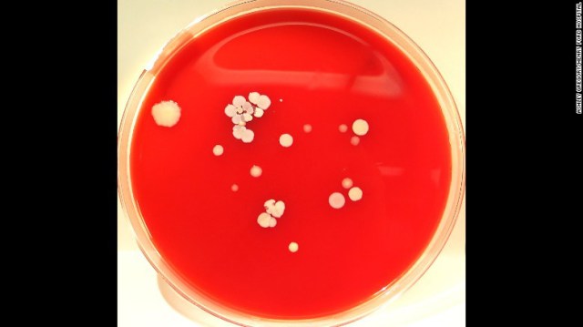 Como parte de un estudio a los trabajadores hospitalarios se les mostró las bacterias comunes que suelen encontrarse en su lugar de trabajo. Foto: Ashley Gregory/Henry Ford Hospital