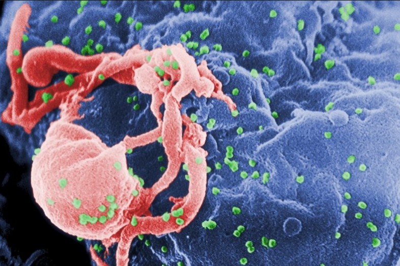 Estudio revela cómo el virus del VIH infecta las células sanas