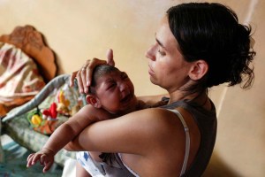 Zika podría causar abortos o tejido cerebral blando en bebés, según estudio