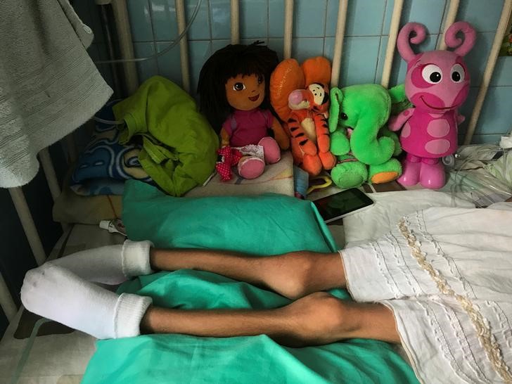Al menos 16 % de los niños venezolanos sufrió de desnutrición en 2017, según ONG