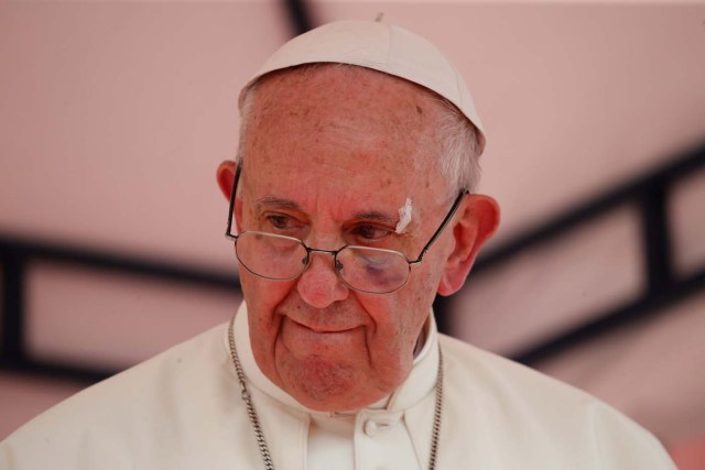 Pope Francis shows a bruise around his left eye and eyebrow caused by an accidental hit against the popemobile's window glass while visiting the old sector of Cartagena, Colombia, September 10, 2017. REUTERS/Stefano Rellandini