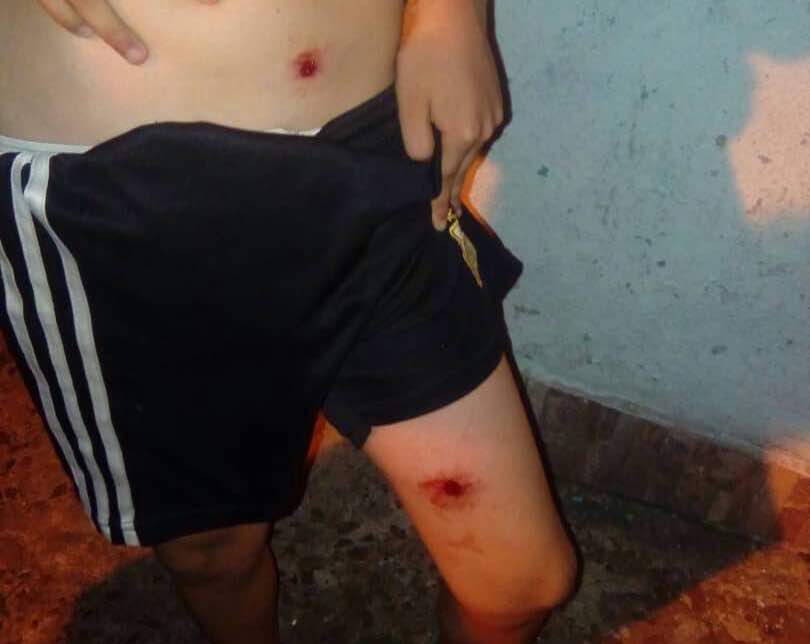 Reportan detenidos y heridos en Táchira en protesta contra el proceso ilegítimo (Video+Foto)