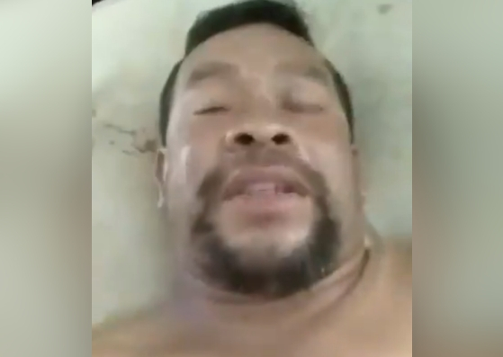 El desgarrador testimonio de un pemón herido en la Gran Sabana: Venezuela levántense ahora (video)