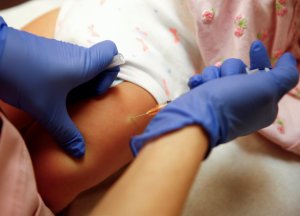La EMA respaldó uso intradérmico de la vacuna Imvanex contra la viruela del mono