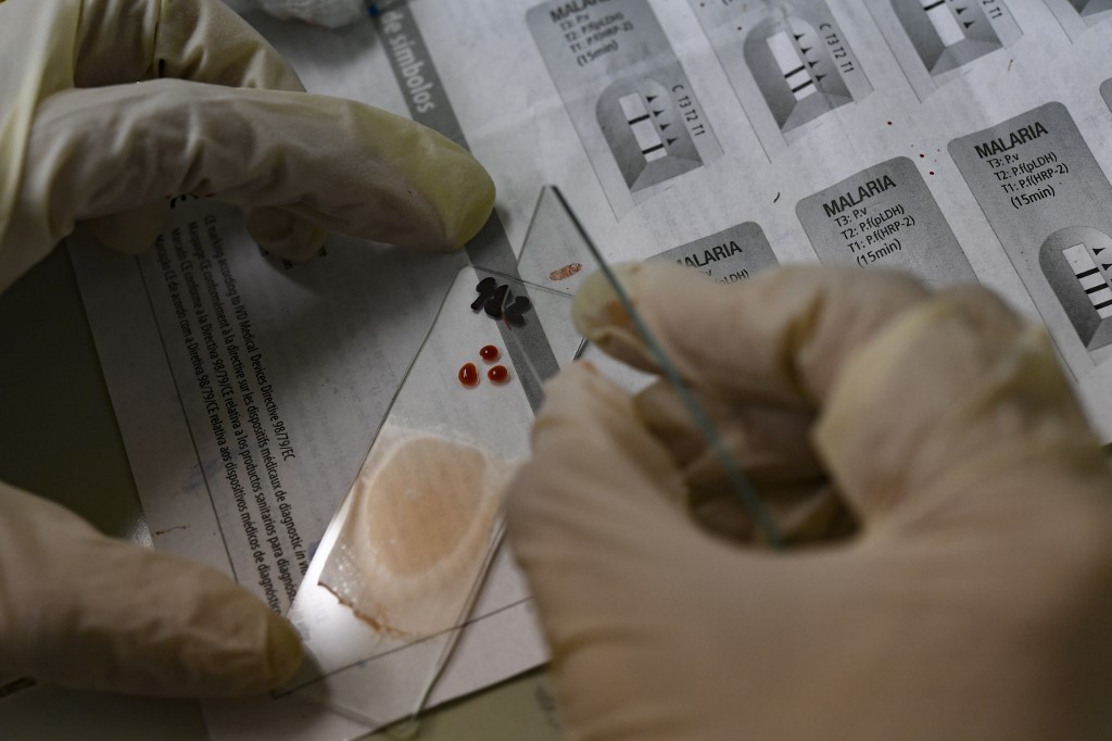 Al menos 18 estados de Venezuela registraron casos de malaria en 2021 pese a restricciones por Covid