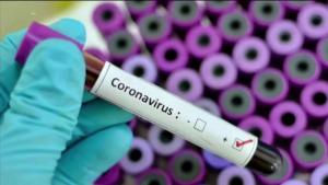 Aumenta a 26 el número de muertes por coronavirus en el Área de la Bahía
