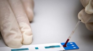 Segundo caso mundial de “curación” de un paciente con el virus del sida