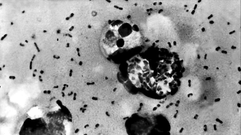 Autoridades alertan sobre la plaga de la peste negra en Estados Unidos