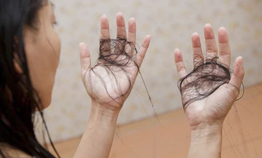 Caída abundante de cabello: Otro efecto secundario que dejaría el coronavirus