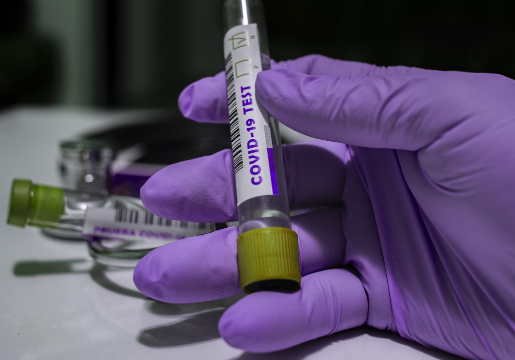 Florida rebasó los 3 mil 600 contagios por coronavirus