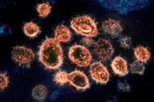 Los anticuerpos IgA tiene un papel primordial para neutralizar el coronavirus