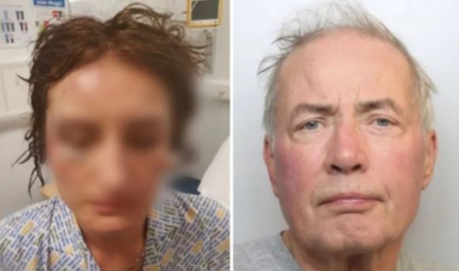 El desgarrador testimonio de una mujer atacada a martillazos por su exesposo en Inglaterra