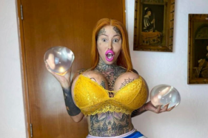 La estrella adulta con la “vagina más gorda del mundo” muestra cómo se veía antes de la operación (Fotos)