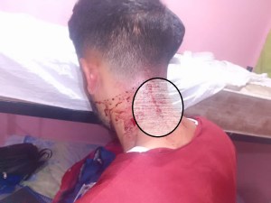 Milagro en Chichiriviche: le dispararon en la cabeza durante atraco y sobrevivió “de chiripa” (FOTOS)