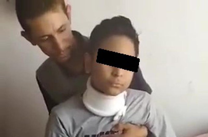 “Lo masacraron, tiene derrame cerebral”: niño venezolano fue agredido por “amiguitos” en Perú