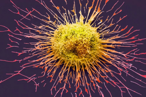 Investigadores del MIT y Harvard develan un papel clave de las proteínas en el desarrollo del cáncer