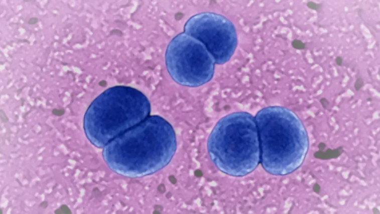 Los CDC advierten a los médicos sobre una infección bacteriana rara y grave con síntomas inusuales